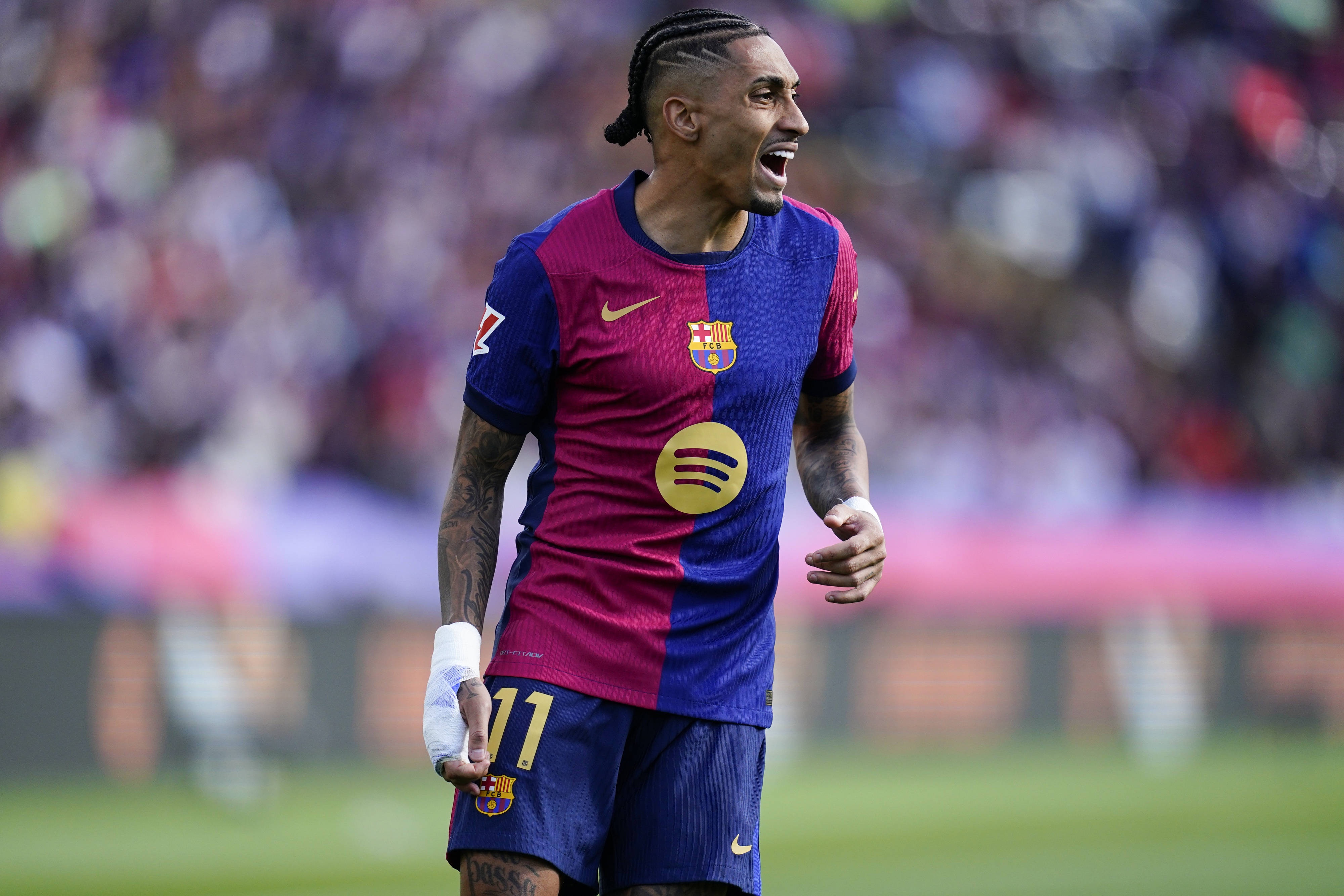 RAC1：拉菲尼亞腿筋受傷，但預計傷勢并不嚴重