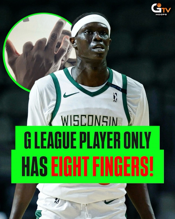 8個指頭也能打籃球！Yor Anei用8根手指打到了G聯(lián)盟！不可思議！