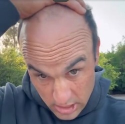 太陽報：前美國國腳多諾萬為脫發(fā)苦惱，向粉絲求助幫忙挑假發(fā)