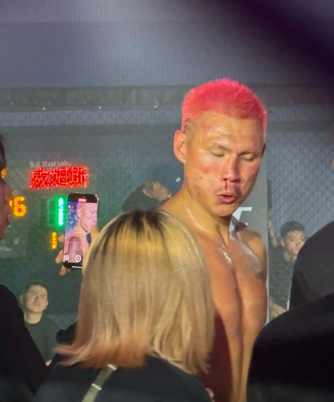 ??骨折了？惡鼠被威姆斯一拳打到面門(mén)！鼻梁已經(jīng)出現(xiàn)嚴(yán)重歪斜！